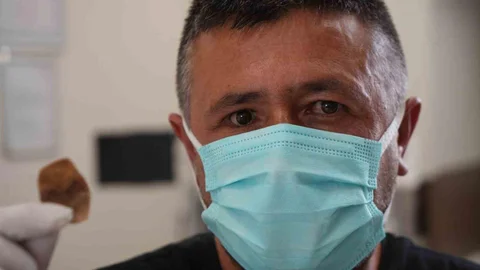 Samsun'da protez göz takılan Ömer Çoban, burnundaki kötü koku nedeniyle sosyal hayatında zorluklar yaşadı.