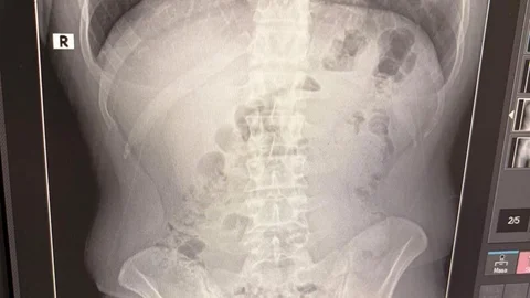 Uşak'ta uyuşturucu ticareti yaptığı belirlenen 3 İranlı şahıs tutuklandı.