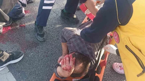 Afyonkarahisar'da motosiklet sürücüsü köpeğe çarpmamak için manevra yapınca bariyerlere çarparak yaralandı.