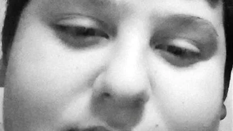 Çorum'da Motosiklet Kazası