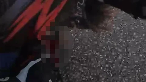 Çanakkale'de motosiklet kazası sonucu ağır yaralanan genç, 25 gün süren tedavi sürecinin ardından yaşamını yitirdi.