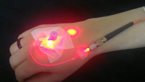 İstanbul'da Lenfödem Uyarısı