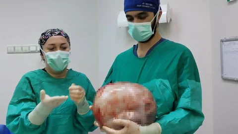 Amasya'da Kitle Ameliyatı Geçiren Kadın Sağlığına Kavuştu