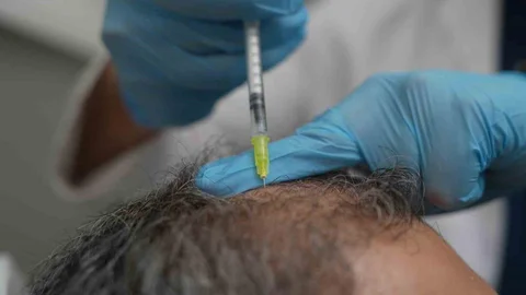 İstanbul'da Saç Dökülmesi Alarmı