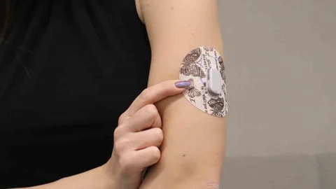 Yapay Pankreas Dönemi Başlıyor