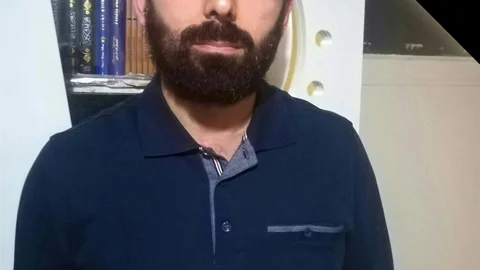 Zonguldak'ta Maden İşçisi Kolu Koparak Ankara'ya Sevk Edildi