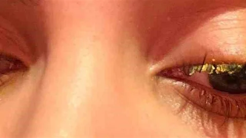 İstanbul'da Güzellik Merkezinde Kaza