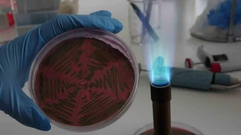 Çiğ Süt İdrar Yolu Enfeksiyonuna Yol Açıyor