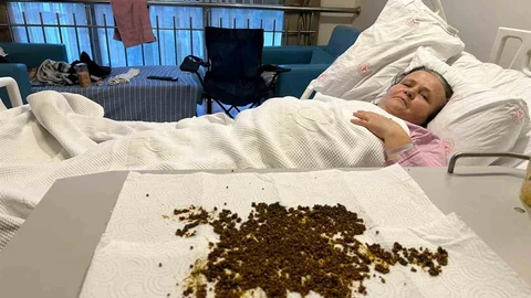 Manisa'da Safra Kesesinden 20 Bin Taş Çıktı