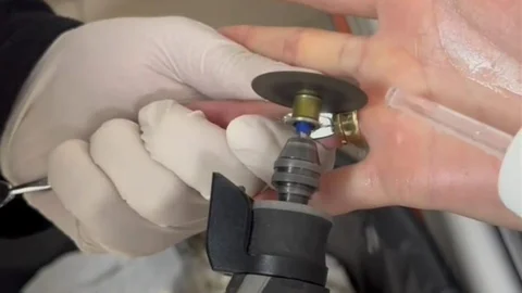 Batman'da Yüzük Kurtarma Operasyonu