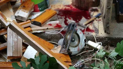 Antalya'da Elektrikli Testere Kazası