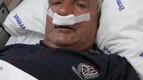 65 Yaşındaki Adamın Burnundan Taş Çıkarıldı