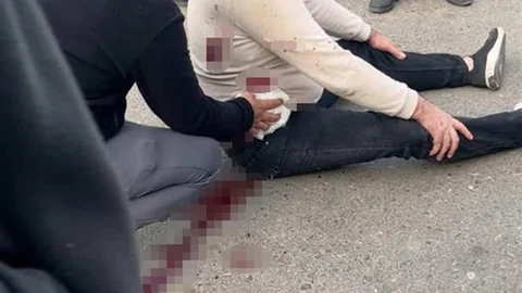 Şanlıurfa'da Bıçaklı Kavga Yaşandı