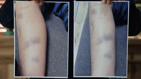 Diyarbakır'da Özel Okulda Darbe İddiası