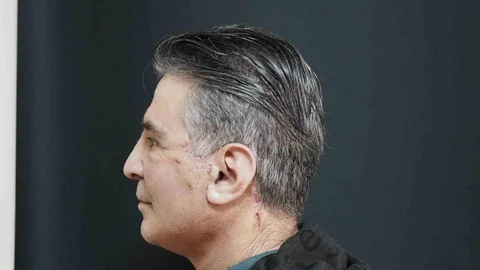 Bitlis'te Yüz Germe Ameliyatı Yapıldı