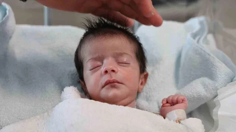 Elazığ'da Doğuştan Yemek Borusu Olmayan Bebek Hayata Tutundu