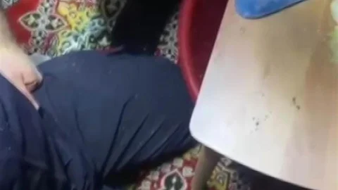 Adana’da Kombi Borusuna Sıkışan Parmağı Kurtarıldı