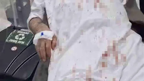 Şanlıurfa'da Yaşlı Adamı Darp Eden Şüpheliler Tutuklandı