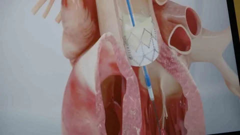 Prof. Dr. Pekdemir: Gençlerde Ani Ölümler Genetik Nedenlerden Kaynaklanıyor