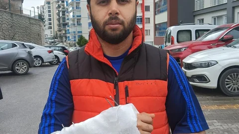 Sahipsiz Köpeklerin Saldırısı Sonucu Bileği Kırıldı