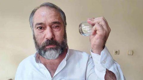 Adana'da Gözünü Kaybeden Genç