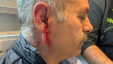 Silivri'de Çalışana Saldırı