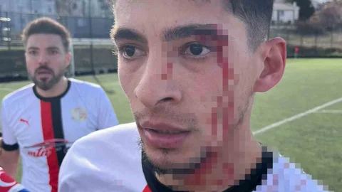 Bilecik'te Amatör Maçta Kavga Çıktı