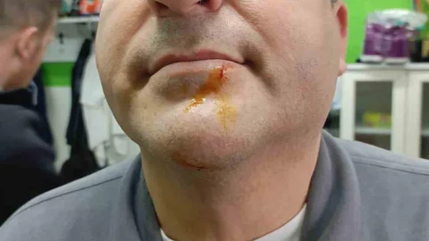 Zonguldak’ta 3. Lig Maçında Kavga Çıktı