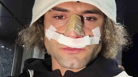 Elazığspor'da Fuat Bavuk'un Burnu Kırıldı