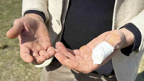 Karabük'te Pitbull Saldırısı