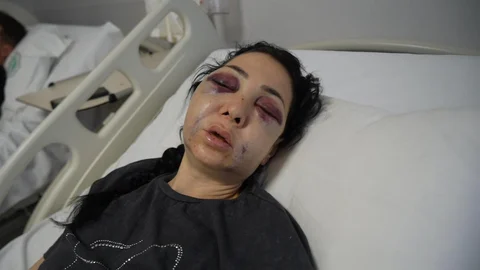 Anne ve Oğluna Darp!