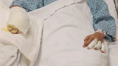 Trabzon'da Ateşe Benzin Döktü