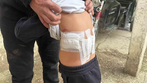 Saldırgan Eşek Çocuğa Saldırdı