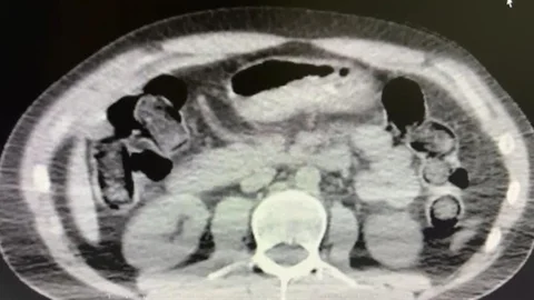 Midelerinde Uyuşturucu Sevkiyatı Yapan İki Torbacı Tutuklandı