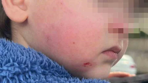 Bursa'da Kreş Skandalı