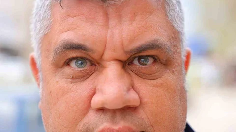 Kahramanmaraş'ta 3 Renkli Gözler Dikkat Çekiyor