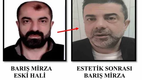Ameliyatla Yüz Değiştiren Cinayet Zanlısı Yakalandı