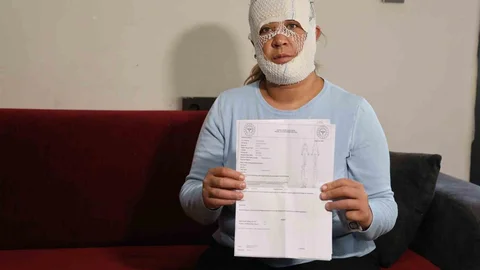 Güzelleşmek İçin Gittiği Merkezde Yüzü Yandı