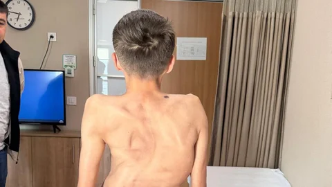 Kırgızistanlı Genç Türk Hekimlerinden Şifa Buldu