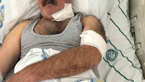 Atın Saldırısı Sonucu Ağır Yaralanma