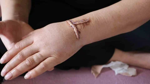 Diyarbakır'da Bıçaklı Saldırı Olayı