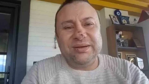 Onur Akay Pitbull Saldırısını Anlattı