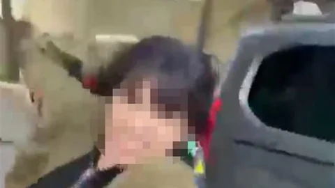 Esenyurt'ta Kadın Eski Eşini Darp Etti