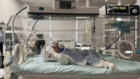 Mardin'de Nadir Hastalıkla Doğan Bebek Sağlığına Kavuştu