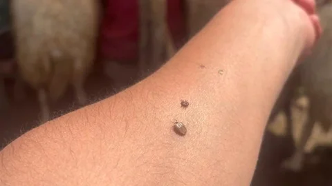 Kene Popülasyonu Artıyor, Tedbirler Alınmalı