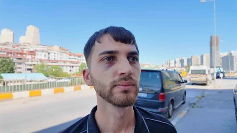 Avcılar'da Sürücü Darp Edildi