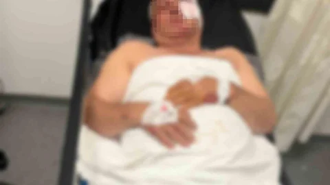 Aydın'da Motosiklet Kazası
