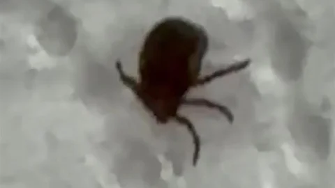 Siirt'te Kene Isırması Vakası