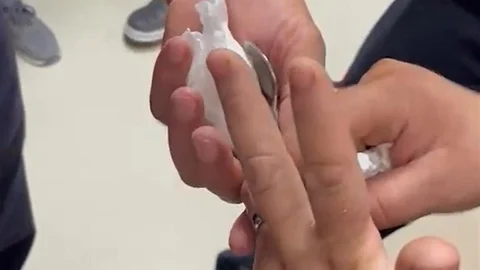 Adana'da Yüzük Sıkışması Olayı