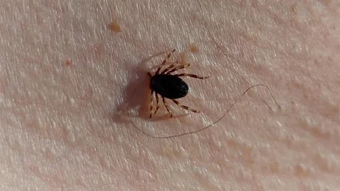 Doğu Karadeniz'de Kene Vakaları Düşük Seyrediyor